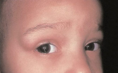 Closeup of a childs eye